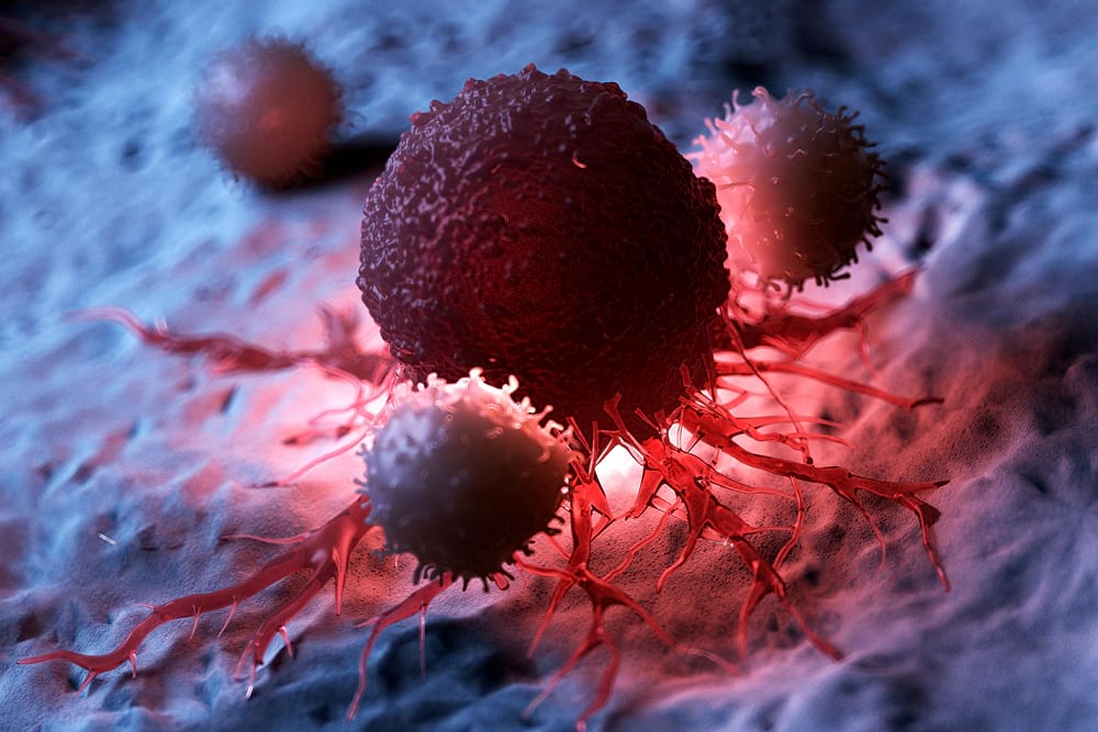 Oncologie